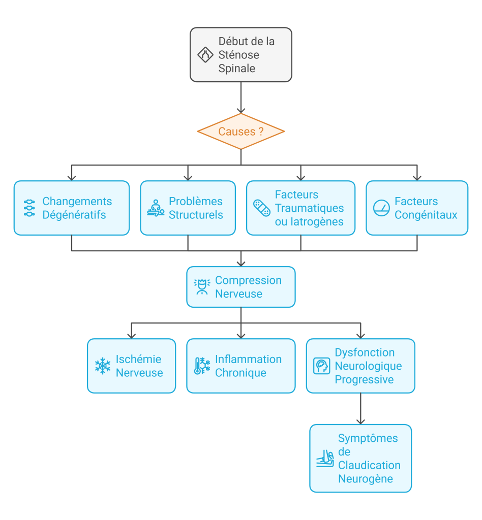 Sténose spinale Décompression neurovertébrale